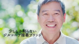 歯の裏側を少し削って接着するジルコニア接着ブリッジ