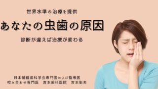 あなたの虫歯の原因