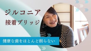 【香川・徳島・愛媛・高知】健康な歯をほとんど削らない！入れ歯や大きな歯削りを避けたい方のための接着ブリッジ治療