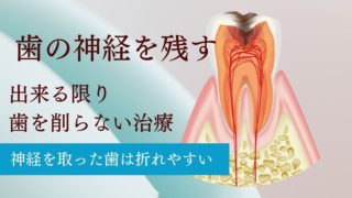 【香川・徳島・愛媛・高知】歯を守りたい50代以上の方へ！歯科医師が語る「歯の神経を残す治療」の重要性