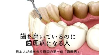【香川・徳島・愛媛・高知】1日3回磨いても歯周病？50代以上の歯に不安がある方必見！歯科医師が教える正しい予防法