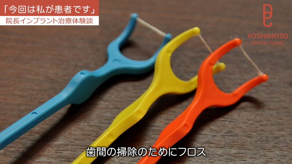 50代から不安になる「歯周病で歯を失うかも?」|香川県高松市の歯科医が教える予防と治療法