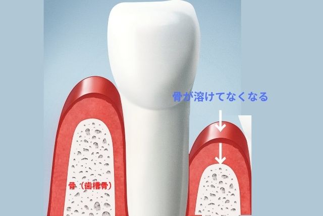 香川県高松市で歯周病治療・歯周病相談をお考えの方へ