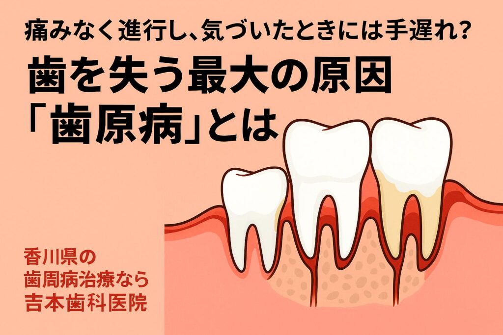 歯周病の本当の原因、見逃していませんか?かみあわせ診断まで行う吉本歯科医院で歯を守る|香川県高松市の歯医者