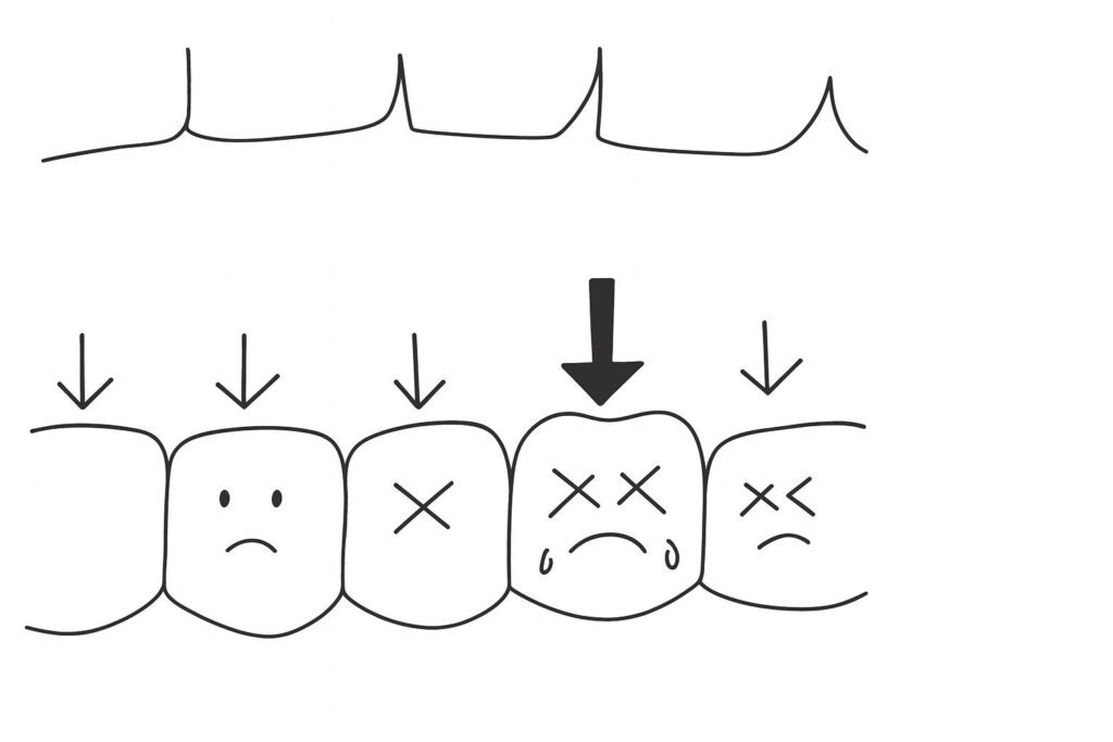 「歯が1本だけ揺れるのは歯周病のサイン?噛み合わせの影響?香川県高松市・吉本歯科医院が徹底解説!」