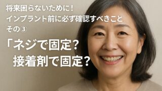 将来困らないために！インプラント前に必ず確認すべきこと　その③ネジで固定？接着剤で固定？