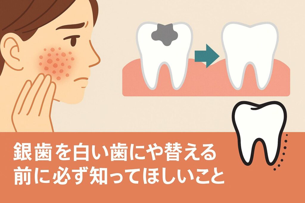銀歯を白い歯に替える前に｜金属アレルギーと再治療リスクを知ってください【香川県高松市 吉本歯科医院】