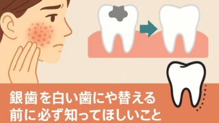 銀歯を白い歯にやり替えるときには必ず読んでください