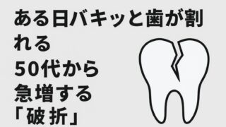50代から急増する歯の破折【私も歯根破折で抜歯しました】