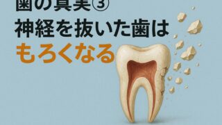 歯の真実③ 神経を抜いた歯はもろくなる