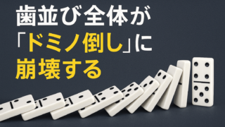 親知らずが原因で、手前の健康な歯が「抜歯」になってしまうことが