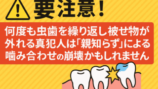 「また虫歯…!?」その終わらない再治療の裏に潜む“真犯人”とは