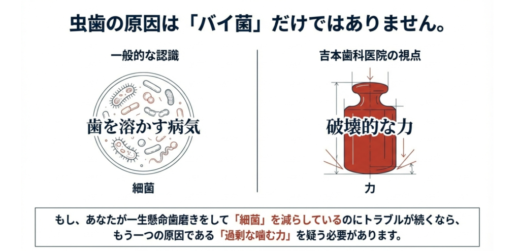 詰め物が何度も外れて虫歯が再発｜咬み合わせ専門の吉本歯科医院【香川県高松市】