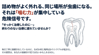 詰め物がよく外れる、同じ場所が虫歯になる。それは「噛む力」が集中している危険信号です
