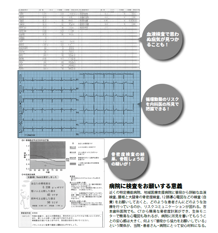 総入れ歯とオールオン4の違いを解説|咬み合わせ専門の吉本歯科医院【香川県高松市】