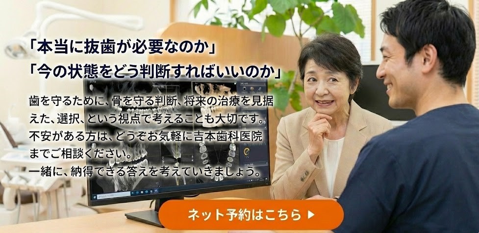 歯を抜きたくない|抜歯と言われた方へ|吉本歯科医院が考える抜歯の基準【香川県高松市】