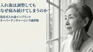 入れ歯が痛い・動く・・・そんなお悩みの方へ「インプラントオーバーデンチャー（固定式入れ歯）」のご紹介