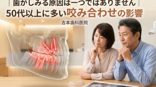 歯がしみる原因は一つではありません。50代以上に多い咬み合わせの影響
