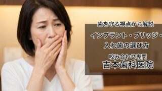 歯を守る視点から見る「インプラント」「ブリッジ」「入れ歯」の選択肢