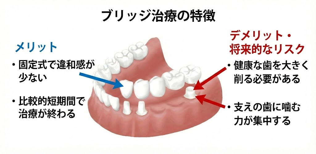 歯を抜いた後、インプラント・ブリッジ・入れ歯どれを選べばいい？咬み合わせ専門の吉本歯科医院【香川県高松市】
