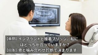 【質問】インプラントと歯をほとんど削らない接着ブリッジ、私にはどっちが合っていますか？