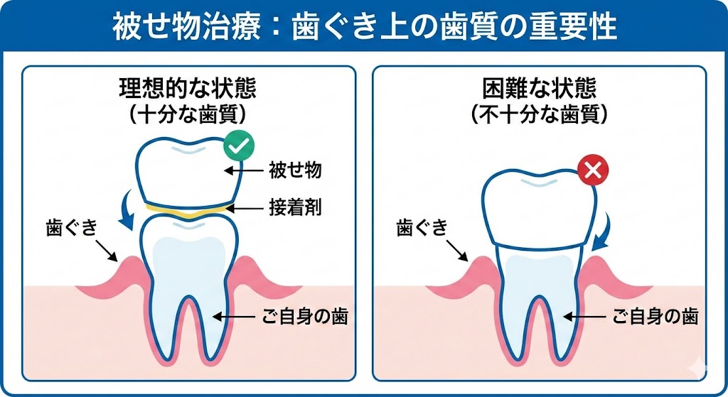 歯を抜きたくない|抜歯と言われた方へ|吉本歯科医院が考える抜歯の基準【香川県高松市】