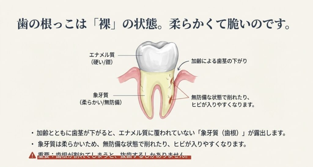 磨きすぎ、硬いものの食べ過ぎが歯を失う原因に?シニア世代に増える「歯根破折」の原因と対策|咬み合わせ専門の吉本歯科医院【香川県高松市】