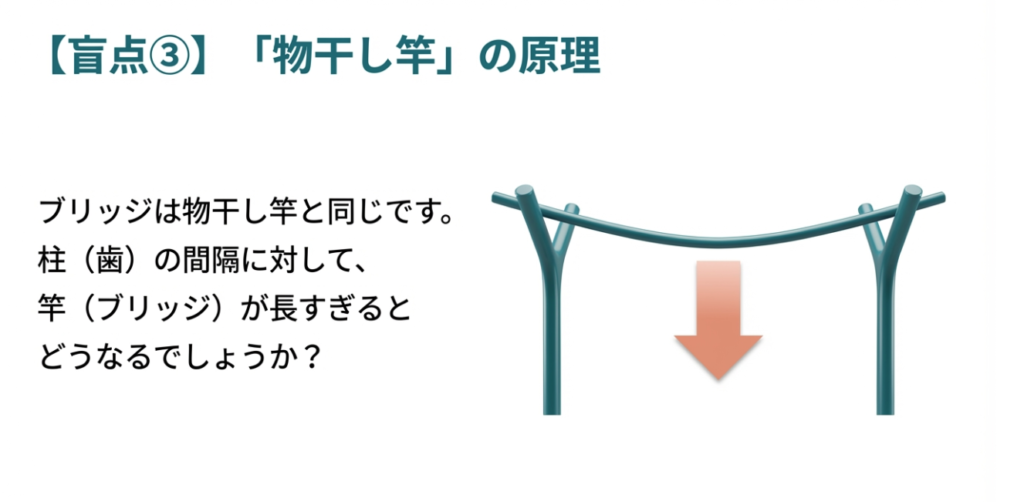 ブリッジ治療の盲点と歯を守るための選択肢|咬み合わせ専門の吉本歯科医院【香川県高松市】