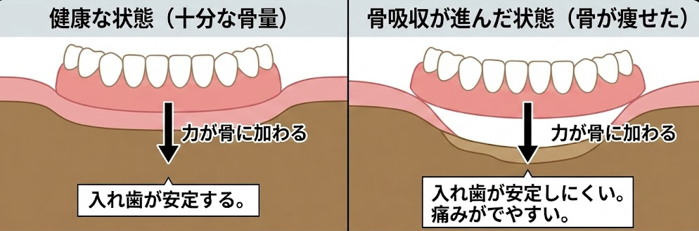 昔の人は入れ歯で噛めていた｜咬み合わせ専門の吉本歯科医院【香川県高松市】