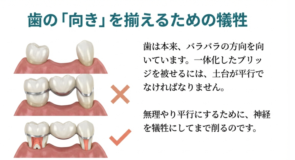 ブリッジ治療の盲点と歯を守るための選択肢|咬み合わせ専門の吉本歯科医院【香川県高松市】