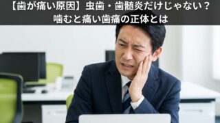 【歯が痛い原因】虫歯・歯髄炎だけじゃない？噛むと痛い歯痛の正体とは
