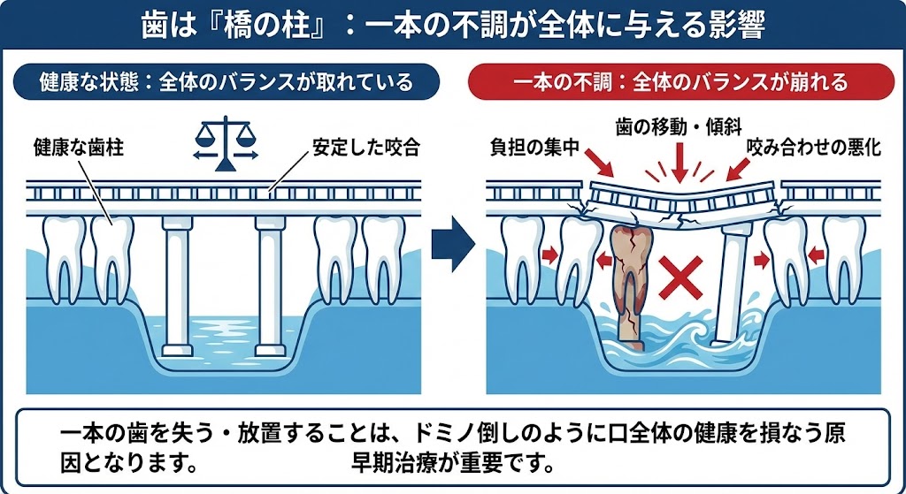 【歯が痛い原因】虫歯・歯髄炎だけじゃない?噛むと痛い歯痛の正体とは|咬み合わせ専門 吉本歯科医院【香川県高松市】
