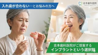 入れ歯が合わない…とお悩みの方へ｜インプラントという選択肢