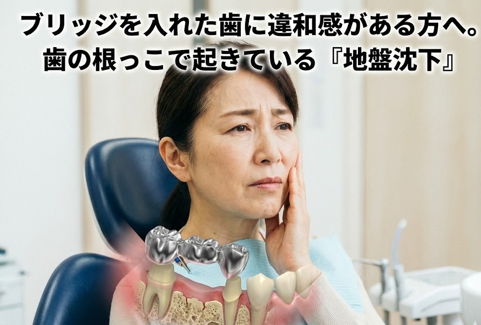 ブリッジを入れた歯に違和感がある方へ。歯の根っこで起きている地盤沈下｜咬み合わせ専門の吉本歯科医院【香川県高松市】