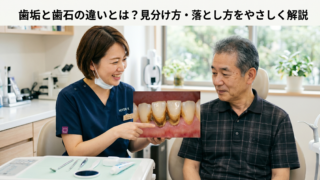歯垢と歯石の違いとは？見分け方・落とし方をやさしく解説