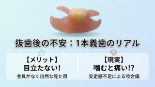 歯を1本抜いたあとの1本義歯｜目立たないけれど噛むと痛いのはなぜ？
