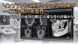 インプラントに重要な骨の厚みと硬さ