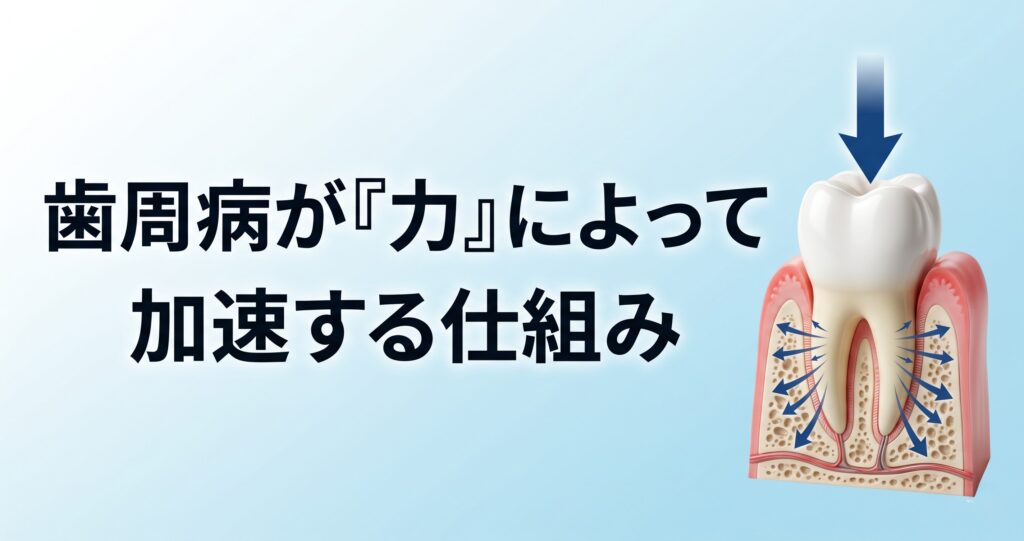 歯周病が「力」によって加速する仕組み｜咬み合わせ専門 吉本歯科医院【香川県高松市】