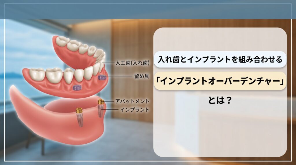 【香川県高松市】入れ歯とインプラントを組み合わせる「インプラントオーバーデンチャー」とは?咬み合わせ専門医が解説