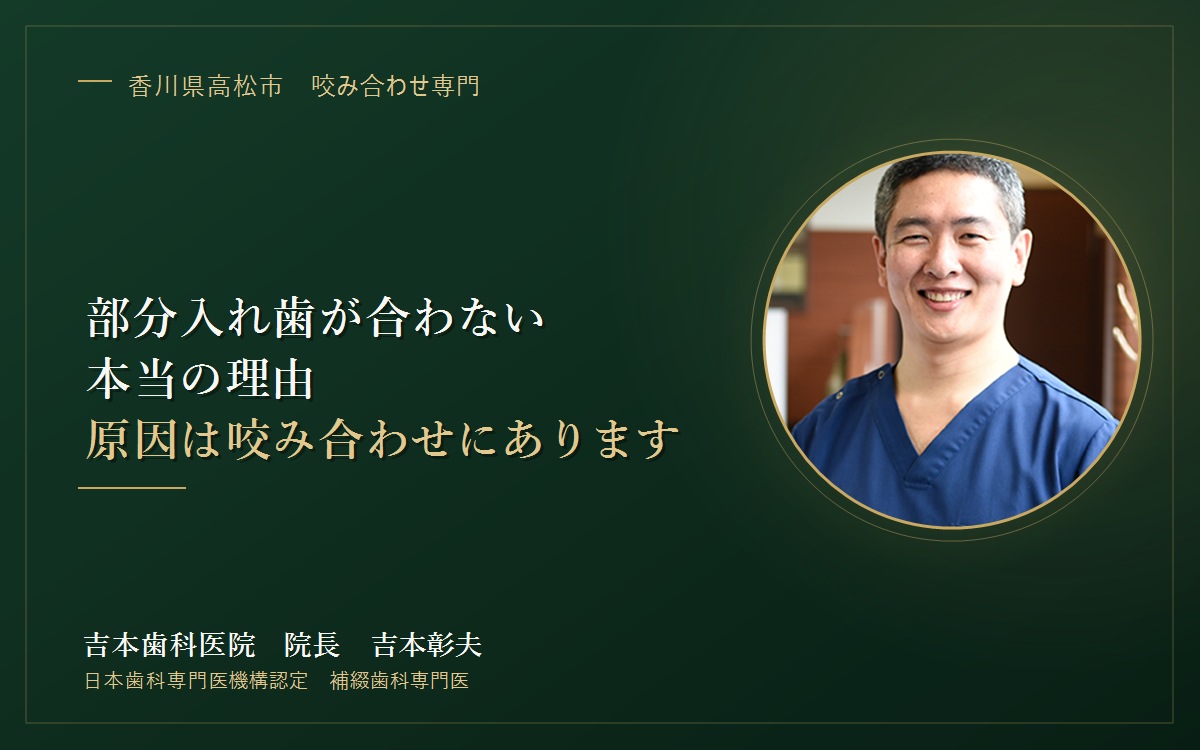 そもそも入れ歯とは、どういう装置なのか。何度作り直しても噛めない本当の理由をご説明します|香川県高松市の咬み合わせ専門 吉本歯科医院