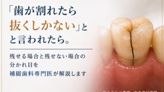 「歯が割れたら抜くしかない」と言われたら。残せる場合と残せない場合の分かれ目を補綴歯科専門医が解説します