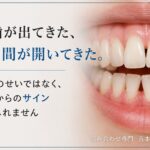 前歯が出てきた・前歯に隙間ができてきた｜香川県高松市の咬み合わせ専門 吉本歯科医院