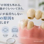 ブリッジが何度も外れる｜支えている歯がぐらついてきた｜香川県高松市の咬み合わせ専門 吉本歯科医院