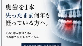 奥歯を1本失ったまま何年も経っている方へ。その1本が抜けたあと、口の中で何が起きているか