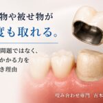 詰め物や被せ物が何度もとれる｜香川県高松市の咬み合わせ専門 吉本歯科医院