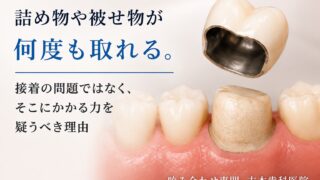 詰め物や被せ物が何度も取れる。接着の問題ではなく、そこにかかる力を疑うべき理由