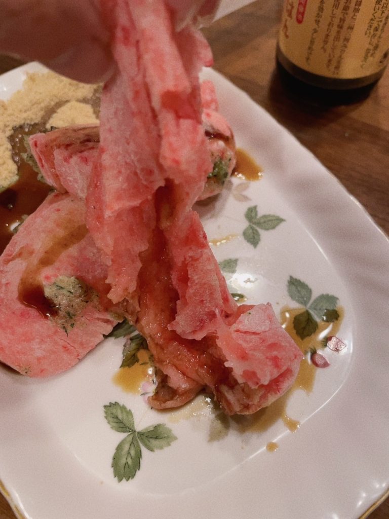 高松市のインプラント　なら吉本歯科医院